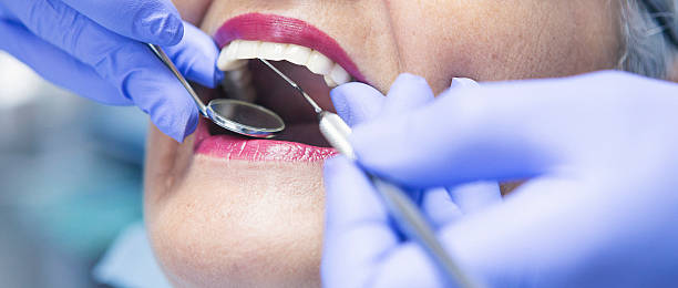 Best Urgent Tooth Repair  in Nneconne, WI